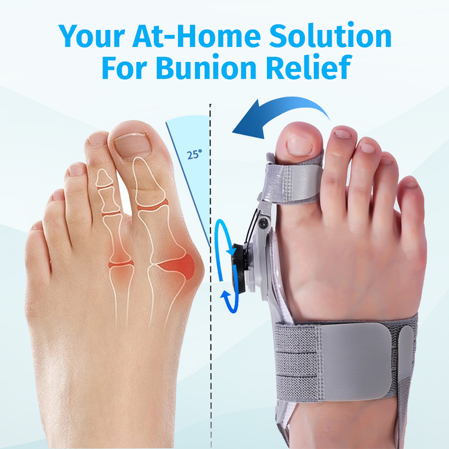 TrincoPro™ Bunion Corrector