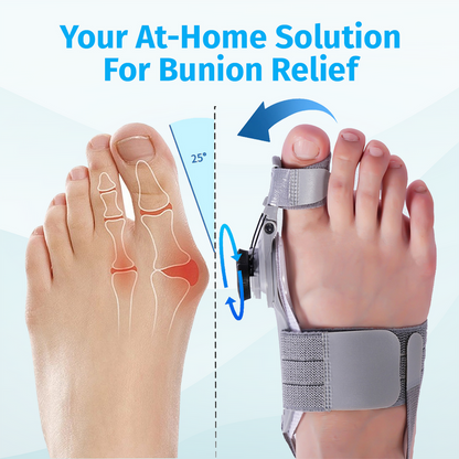 TrincoPro™ Bunion Corrector