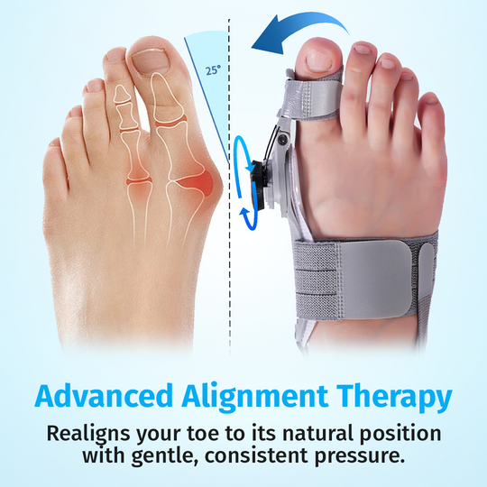 TrincoPro™ Bunion Corrector
